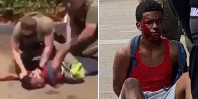Justice For Lucca! Video Shows A 15-Year Old Black Boy Getting Brutally Attacked By Broward County Police Officers During An Arrest