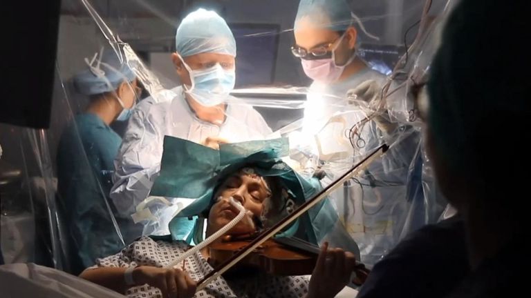 Woman Plays Violin While Undergoing Brain Surgery To Remove A Tumor