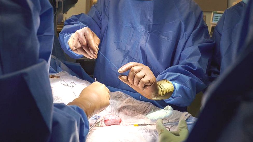 U.S. Surgeons Test Pig Kidney Transplant In A Human