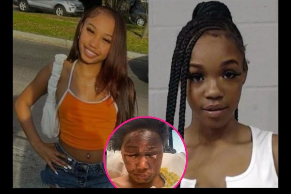 Teen Gets 3 Years In Prison for Throwing Acid on 17-Year-Old Girl During Fight